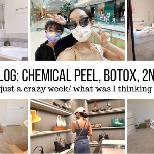 CHEMICAL PEEL // BOTOX // VACCINE // MAJOR ANXIETY // NIKE HAUL // Jessica Tull vlogs